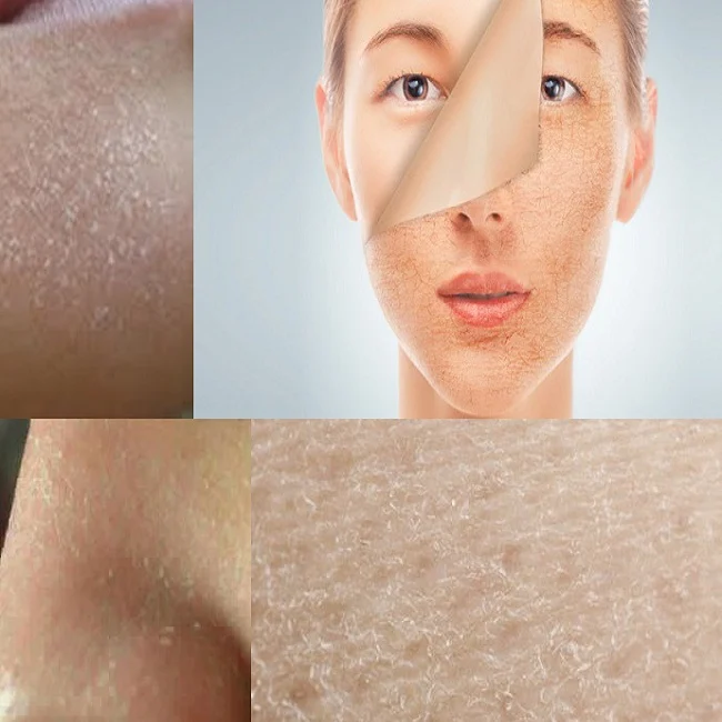 Serum cấp ẩm